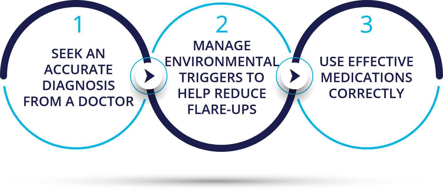 Managing allergies in the workplace