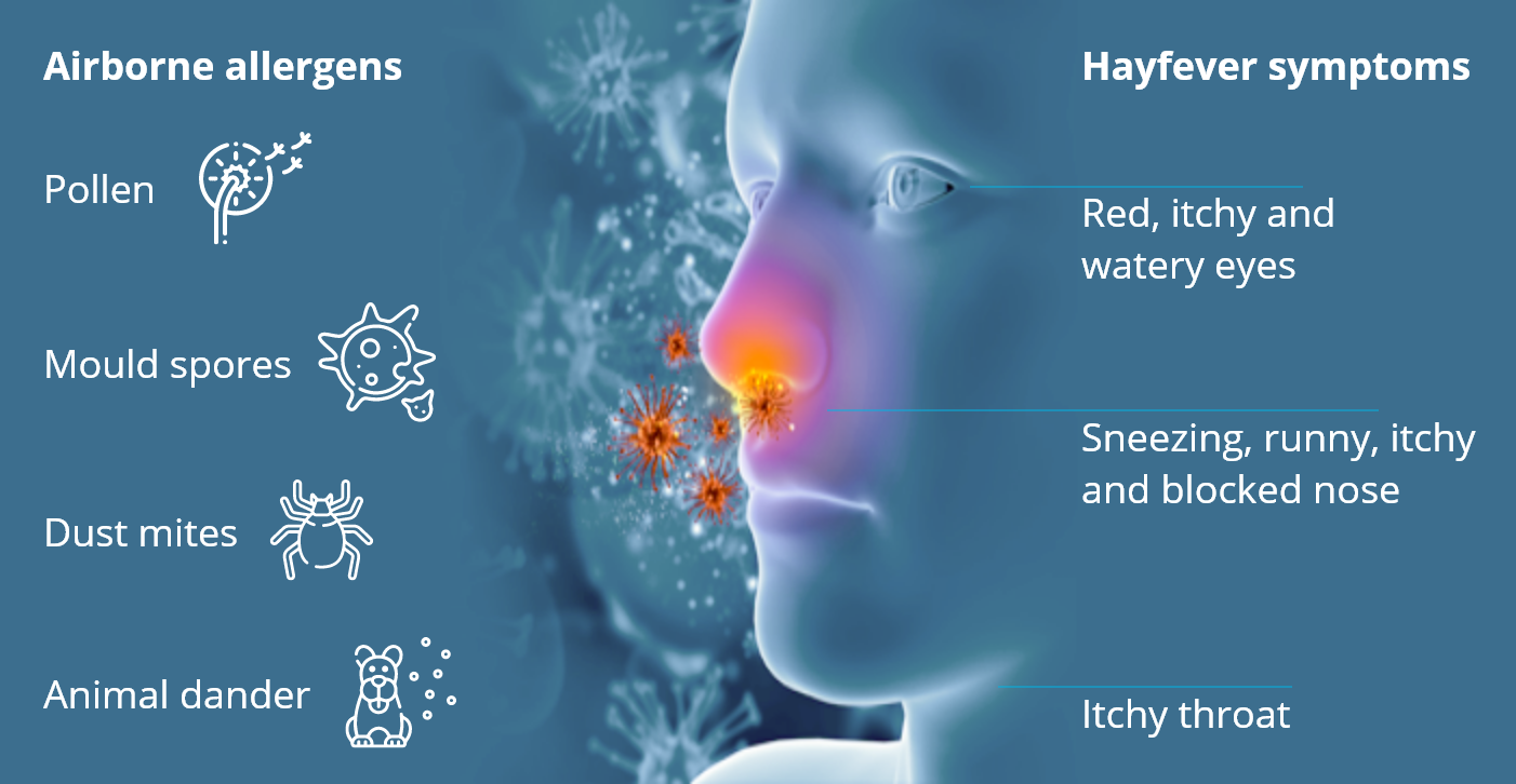 What is hayfever? Causes of Hayfever in Australia My Hayfever